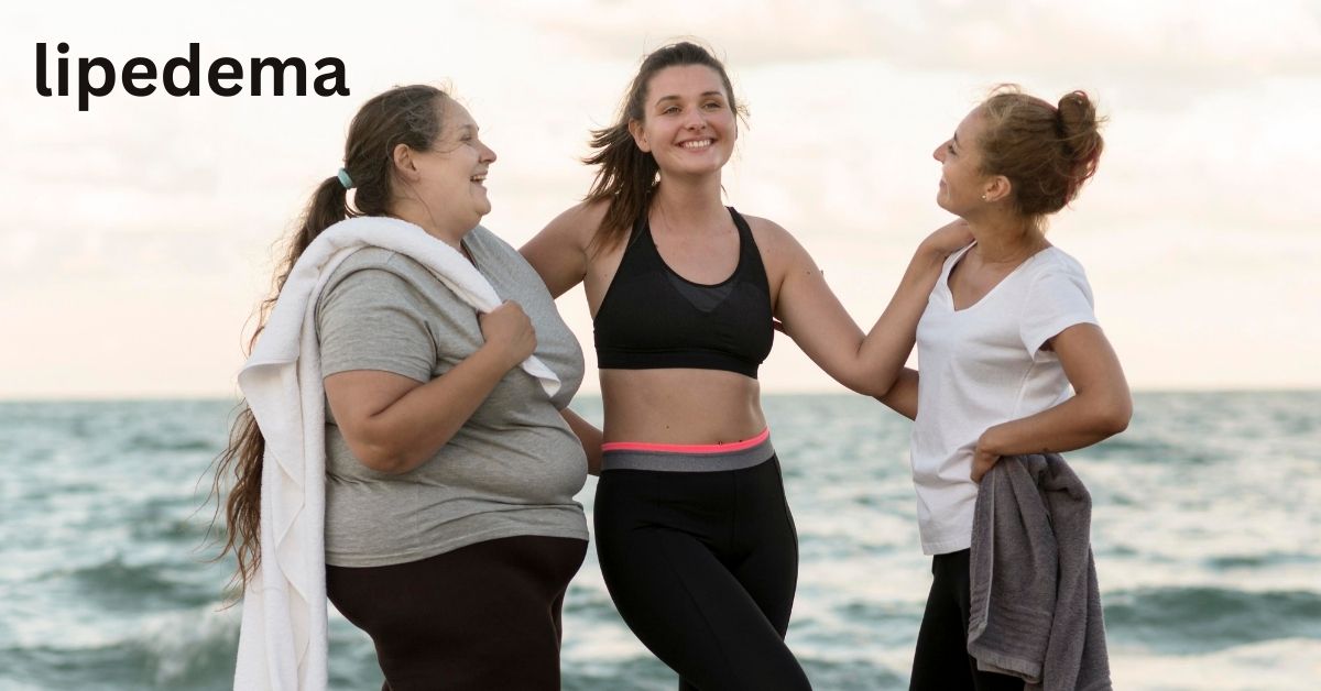 Celebrities with Lipedema